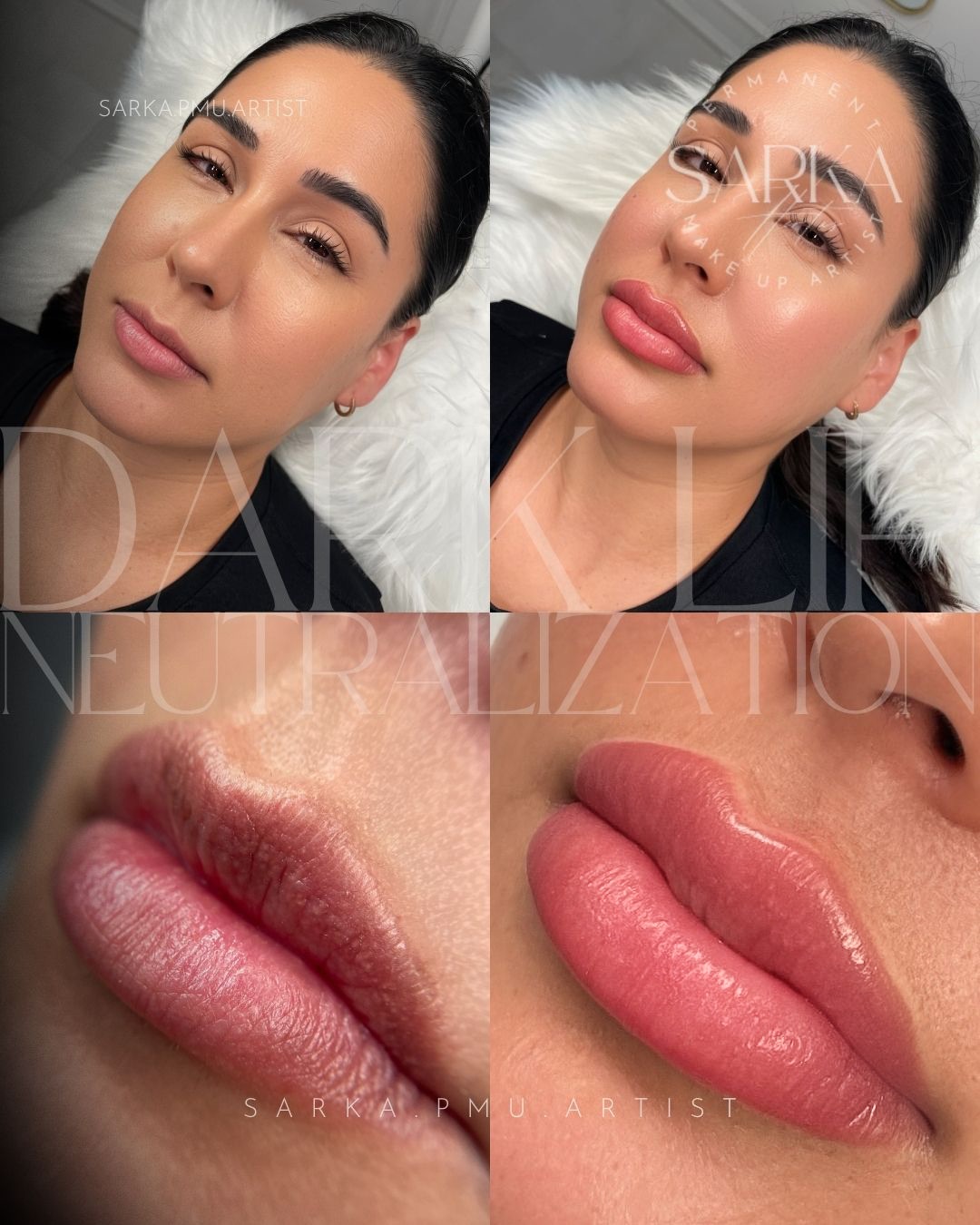 Dark lip neutralization results